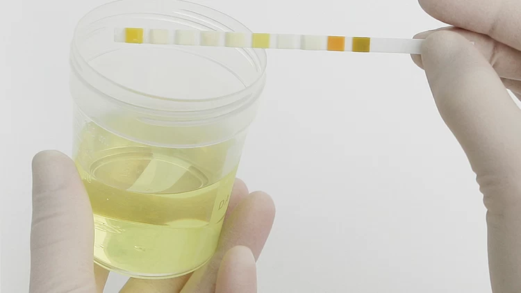 Roche Combur 3 E Test Strips - 50 Pieces - Image 4